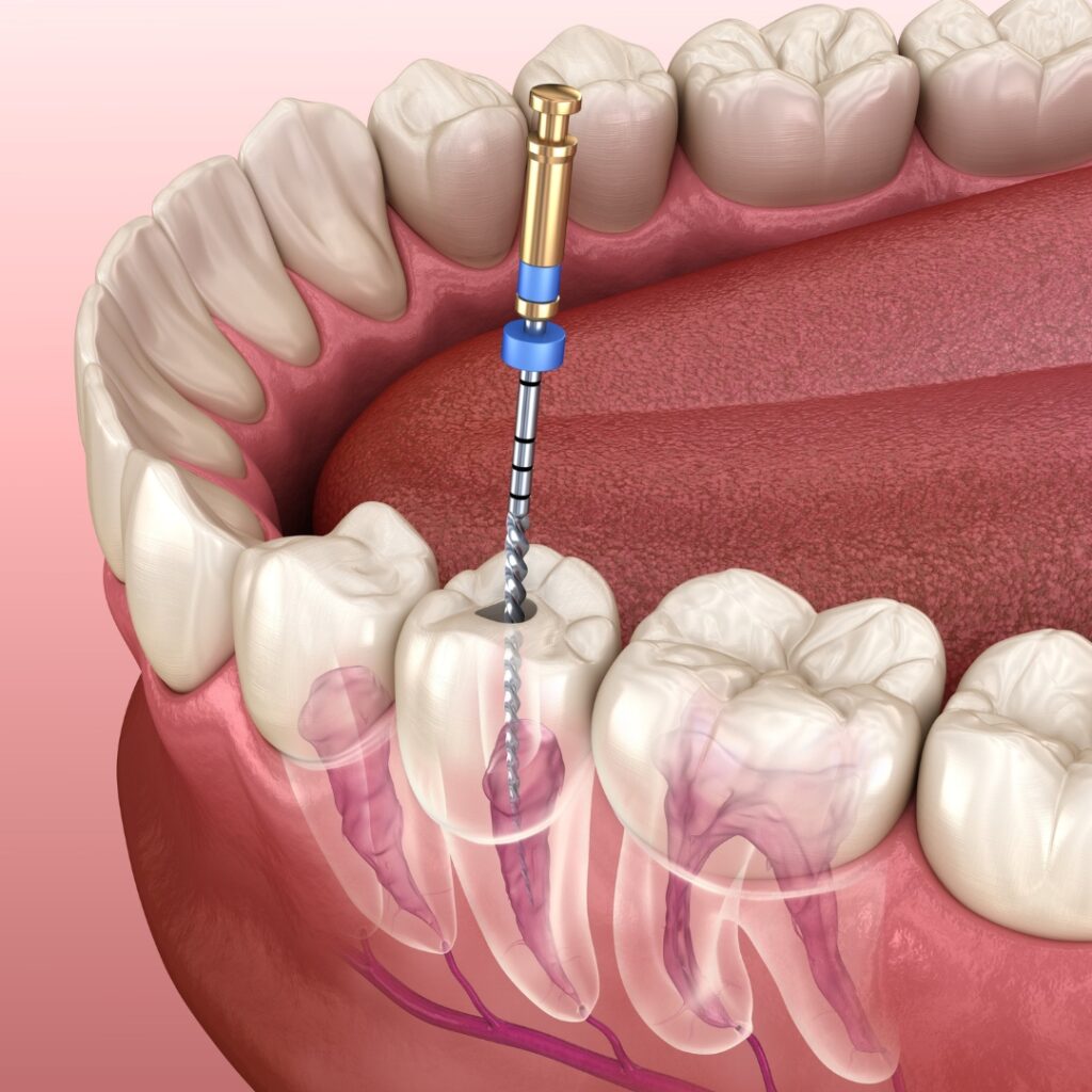 Dental health tips in our educational blog at EasyCare Family Dental