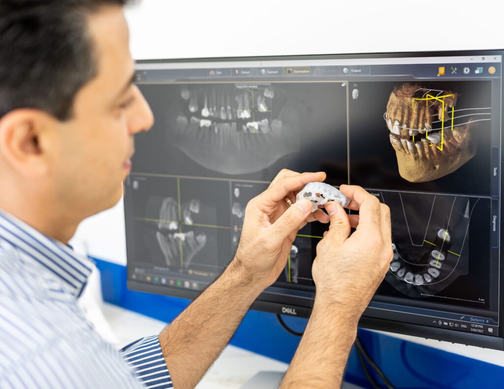 Invisalign 3D scan at EasyCare Family Dental near Norman Park QLD – clear aligners for a straighter smile.