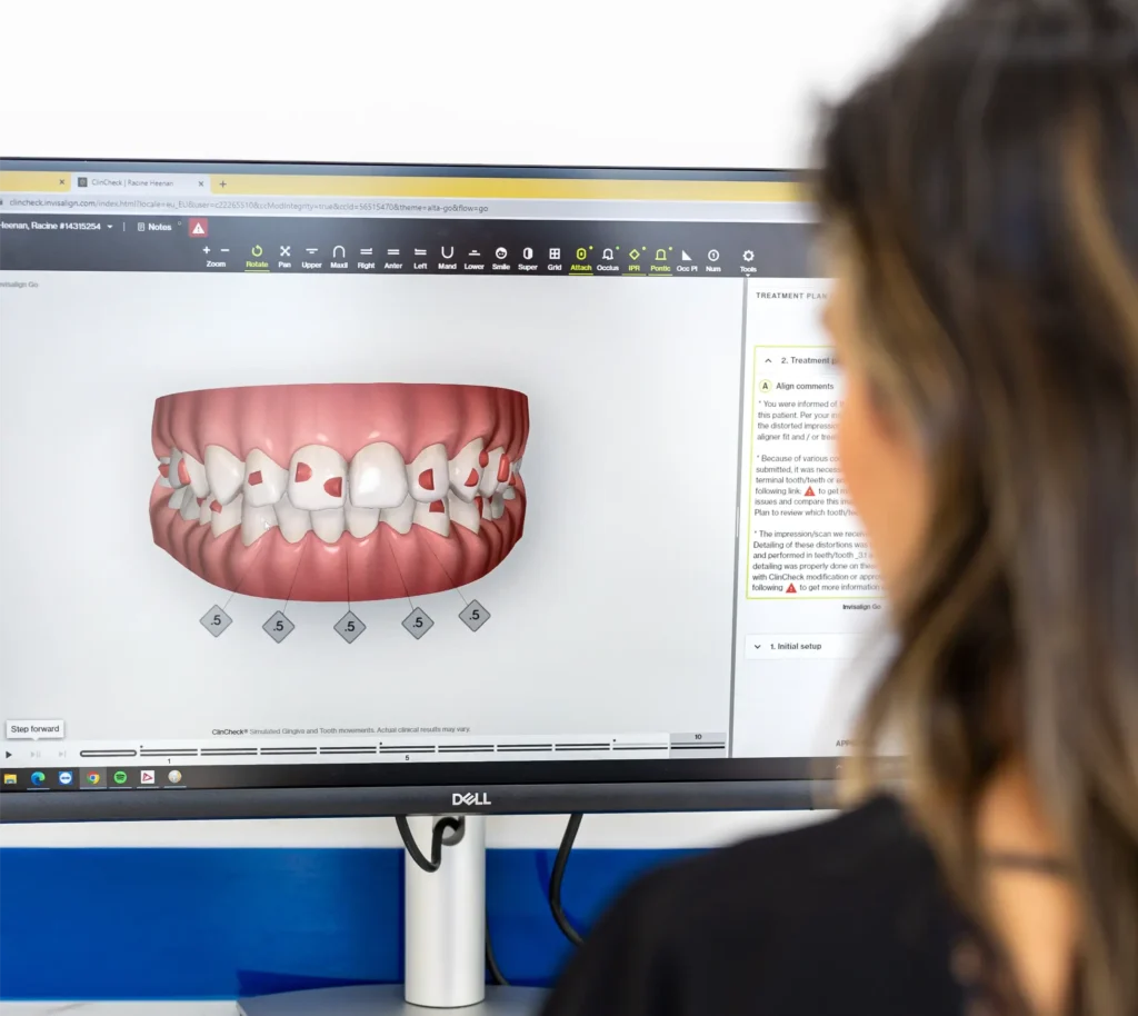 Invisalign 3D scan at EasyCare Family Dental near Hawthorne QLD – clear aligners for a straighter smile.