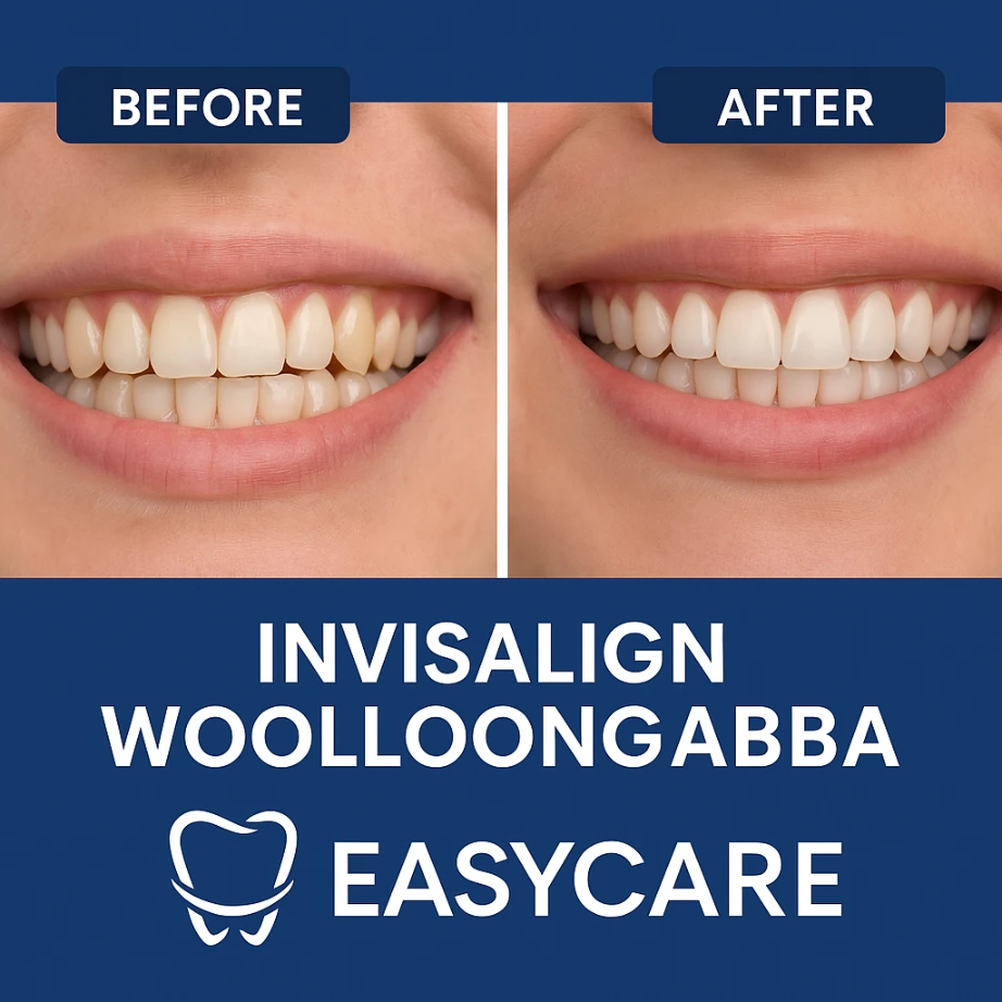Invisalign Before & After | EasyCare Woolloongabba Before and after Invisalign treatment – EasyCare Family Dental Woolloongabba