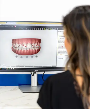 Invisalign Provider in East Brisbane