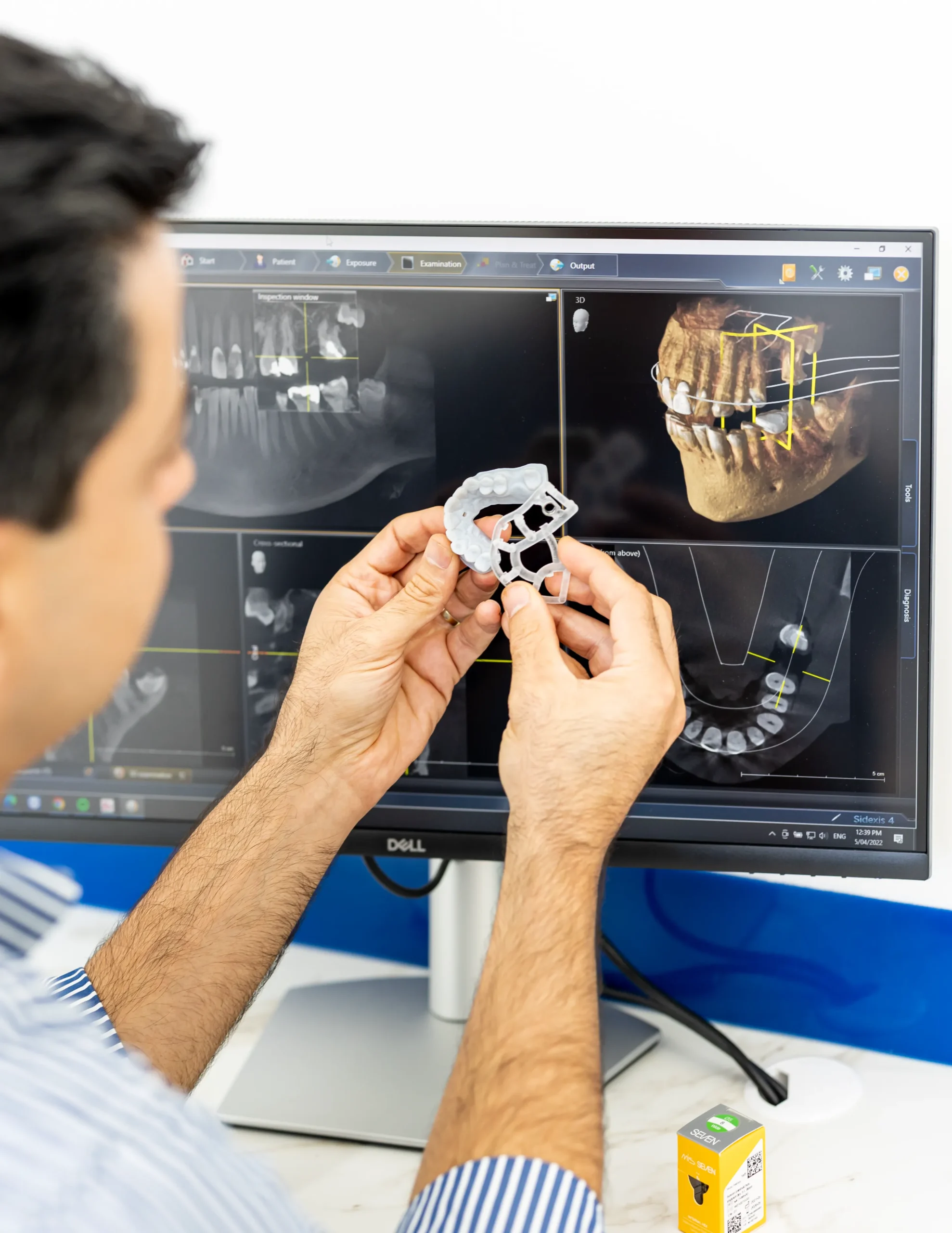 3D Smile Design Planning