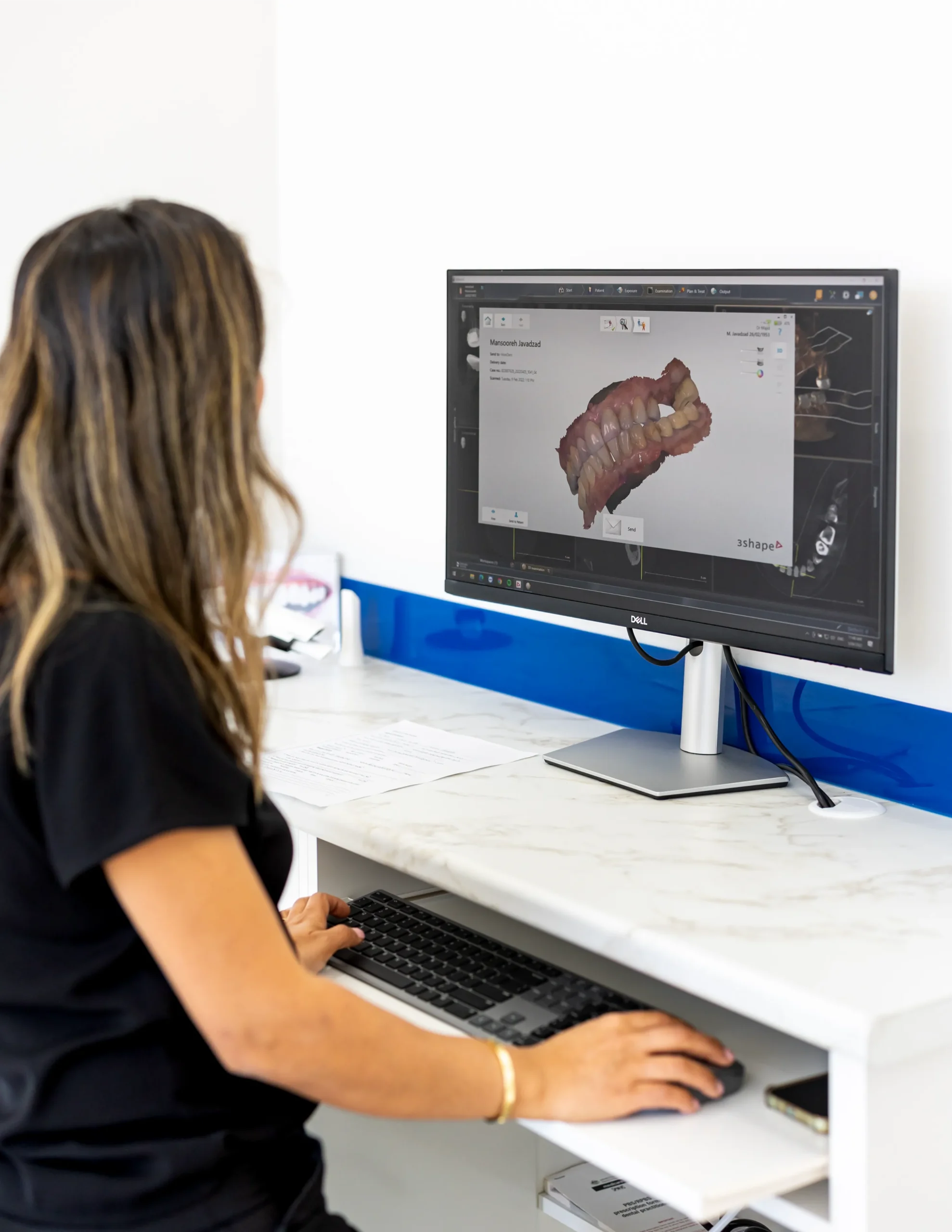 3Shape Trios Intraoral Scanning